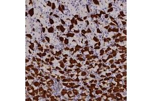 Immunohistochemical staining of human stomach with RTTN polyclonal antibody  shows strong cytoplasmic positivity in gastric parietal cells at 1:200-1:500 dilution. (Rotatin (RTTN) antibody)