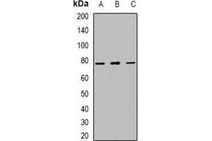 Western blot analysis of MUM1 expression in mouse kidney (A), mouse heart (B), mouse brain (C) whole cell lysates.