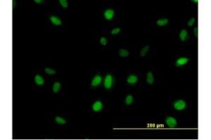 Image no. 3 for anti-Mediator Complex Subunit 21 (MED21) (AA 1-145) antibody (ABIN599079) (MED21 antibody  (AA 1-145))