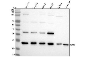 Western blot analysis of FGF19 using anti-FGF19 antibody (ABIN7604838).