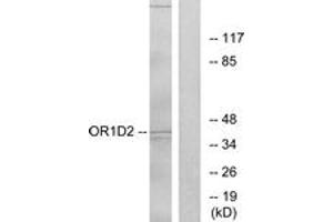 Western blot analysis of extracts from Jurkat cells, using OR1D2 Antibody. (OR1D2 antibody  (AA 201-250))