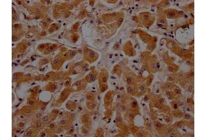 IHC image of ABIN7127343 diluted at 1:100 and staining in paraffin-embedded human liver tissue performed on a Leica BondTM system. (Recombinant APOC3 antibody)