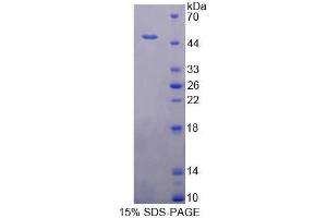 SDS-PAGE (SDS) image for Cardiac Troponin C (TNNC1) (AA 1-161) protein (His tag,GST tag) (ABIN6237413)