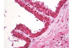 Human Prostate: Formalin-Fixed, Paraffin-Embedded (FFPE) (Centaurin beta 2 antibody  (AA 350-400))