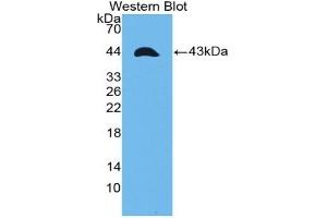 Detection of Recombinant TNFRSF12A, Human using Polyclonal Antibody to Tumor Necrosis Factor Receptor Superfamily, Member 12A (TNFRSF12A) (TNFRSF12A antibody  (AA 24-126))