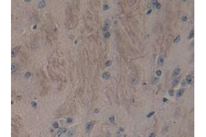 Detection of ADAMTS2 in Mouse Cerebrum Tissue using Polyclonal Antibody to A Disintegrin And Metalloproteinase With Thrombospondin 2 (ADAMTS2) (Adamts2 antibody  (AA 855-1030))