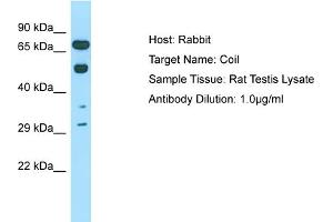 Host: Rabbit Target Name: COIL Sample Tissue: Rat Testis Antibody Dilution: 1ug/ml (Coilin antibody  (C-Term))