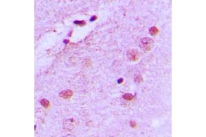 Immunohistochemical analysis of Nucleophosmin (pT199) staining in human brain formalin fixed paraffin embedded tissue section. (NPM1 antibody  (pSer199))