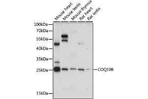 COQ10B antibody  (AA 38-150)
