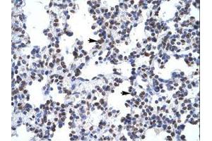 Image no. 1 for anti-Glial Cells Missing Homolog 1 (GCM1) (N-Term) antibody (ABIN6735857) (GCM1 antibody  (N-Term))