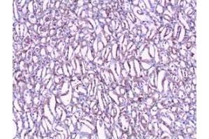 Immunohistochemical staining of formalin-fixed paraffin-embedded human kidney tissue showing nuclear and cytoplasmic staining with CLIC1 polyclonal antibody  at 1 : 100 dilution.