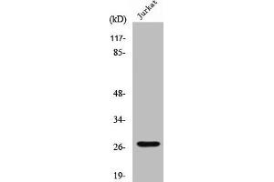 CTSC Antikörper  (Cleaved-Arg394)