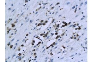 Formalin-fixed and paraffin embedded human endometrial tissue labeled with Anti-XIAP/BIRC4 Polyclonal Antibody, Unconjugated (ABIN674364) followed by conjugation to the secondary antibody and DAB staining (XIAP antibody  (AA 201-330))