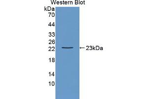 Figure. (LAT2 antibody  (AA 29-193))