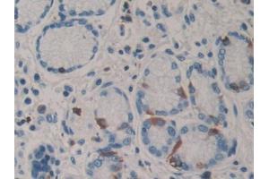 DAB staining on IHC-P; Samples: Human Stomach Tissue (PARN antibody  (AA 178-245))