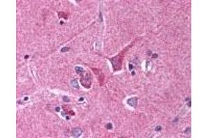 Immunohistochemistry (IHC) image for anti-Slit Homolog 1 (SLIT1) (AA 155-173) antibody (ABIN2470344) (SLIT1 antibody  (AA 155-173))