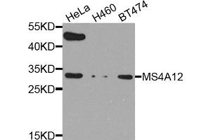 Western blot analysis of extracts of various cell lines, using MS4A12 antibody (ABIN5974527) at 1/1000 dilution. (MS4A12 antibody)