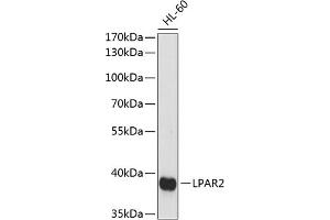 Western blot analysis of extracts of HL-60 cells, using LP antibody (ABIN7268335) at 1:1000 dilution. (EDG4 antibody  (AA 250-350))