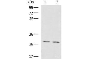 Western blot analysis of Mouse brain tissue Mouse kidney tissue lysates using KRCC1 Polyclonal Antibody at dilution of 1:1350 (KRCC1 antibody)