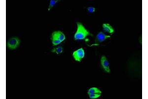 Immunofluorescence staining of MCF-7 cells with ABIN7142640 at 1:100, counter-stained with DAPI.