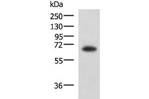 Western blot analysis of PC3 cell lysate using SHC3 Polyclonal Antibody at dilution of 1:650 (SHC3 antibody)