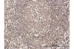 Immunoperoxidase of purified MaxPab antibody to OLIG3 on formalin-fixed paraffin-embedded human lymph node. (OLIG3 antibody  (AA 1-272))