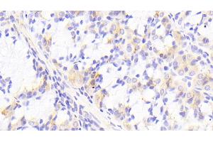 Detection of PTPRK in Human Stomach Tissue using Polyclonal Antibody to Protein Tyrosine Phosphatase Receptor Type K (PTPRK) (PTPRK antibody  (AA 1185-1440))