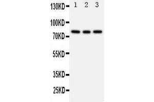 Western Blotting (WB) image for anti-Phosphoinositide 3 Kinase, p85 beta (PI3K p85b) (AA 447-461), (Middle Region) antibody (ABIN3044260) (PIK3R2 antibody  (Middle Region))