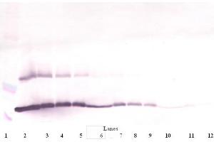Western Blot (Reduced) using TSLP antibody (Thymic Stromal Lymphopoietin antibody)