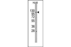 Image no. 1 for anti-HIR Histone Cell Cycle Regulation Defective Homolog A (HIRA) (Middle Region) antibody (ABIN358780)