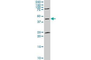 GNAL polyclonal antibody (A01), Lot # ABNOVA060627QCS1. (GNAL antibody  (AA 359-458))