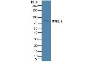 Detection of C2 in Rat Serum using Polyclonal Antibody to Complement Component 2 (C2) (Complement C2 antibody  (AA 473-723))
