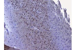 IHC analysis of NRF1 using anti-NRF1 antibody (ABIN6719347).