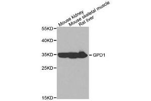 Western blot analysis of extracts of various cell lines, using GPD1 antibody. (GPD1 antibody  (AA 1-349))