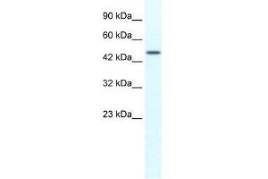 Human HepG2; WB Suggested Anti-TRIM39 Antibody Titration: 1. (TRIM39 antibody)