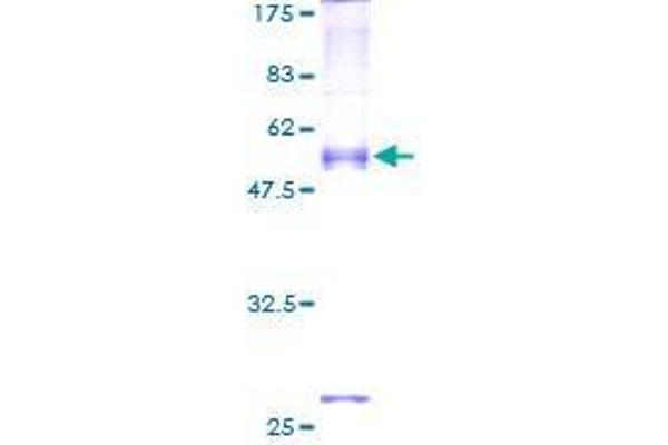 SEC22A Protein (AA 1-307) (GST tag)