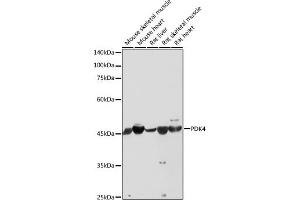 Western blot analysis of extracts of various cell lines, using PDK4 antibody (ABIN6132477, ABIN6145396, ABIN6145397 and ABIN6217290) at 1:1000 dilution. (PDK4 antibody  (AA 102-411))