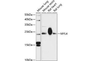 Western blot analysis of extracts of various cell lines, using MYL4 antibody (ABIN6129614, ABIN6144252, ABIN6144254 and ABIN6217179) at 1:3000 dilution. (MYL4 antibody  (AA 1-197))