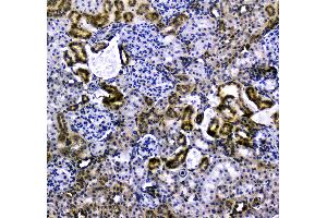 IHC analysis of VCAM1 using anti-VCAM1 antibody . (VCAM1 antibody  (AA 25-270))