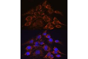 Immunofluorescence analysis of C6 cells using HPS4 antibody (ABIN7267623) at dilution of 1:100. (HPS4 antibody  (AA 550-650))