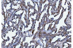 IHC analysis of Axin 2/AXIN2 using anti-Axin 2/AXIN2 antibody (ABIN7602177).