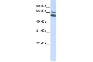 MYH10 antibody used at 1 ug/ml to detect target protein. (MYH10 antibody  (N-Term))
