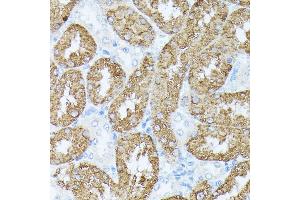 Immunohistochemistry of paraffin-embedded rat kidney using PLS1 antibody (ABIN7269391) at dilution of 1:100 (40x lens). (PLS1 antibody  (AA 1-110))