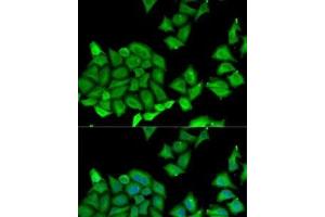 Immunofluorescence analysis of U2OS cells using RPS7 Polyclonal Antibody