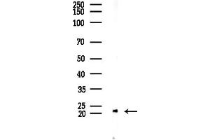 anti-Transgelin (TAGLN) (C-Term) antibody