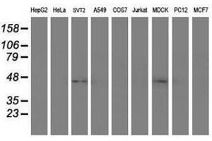 Image no. 2 for anti-serpin Peptidase Inhibitor, Clade A (Alpha-1 Antiproteinase, Antitrypsin), Member 5 (SERPINA5) antibody (ABIN1500058) (SERPINA5 antibody)