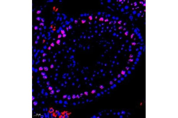 CHD1L antibody