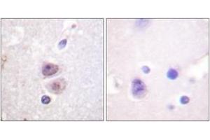 Immunohistochemistry (IHC) image for anti-Mitogen-Activated Protein Kinase 14 (MAPK14) (AA 288-337) antibody (ABIN2888769) (MAPK14 antibody  (AA 288-337))