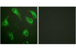 Immunofluorescence analysis of HeLa cells, using CD88/C5aR (Ab-338) Antibody. (C5AR1 antibody  (AA 301-350))