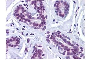 Human Breast: Formalin-Fixed, Paraffin-Embedded (FFPE) (Retinoblastoma Binding Protein 8 antibody)